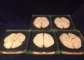 5 Kilgore Human Brain Sections in Acrylic Lucite CAT Scan Slice CT
