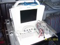 Acuson Cypress Portable Ultrasound